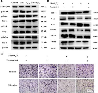 Corrigendum: PPy@Fe3O4 nanoparticles inhibit the proliferation and metastasis of CRC via suppressing the NF-κB signaling pathway and promoting ferroptosis